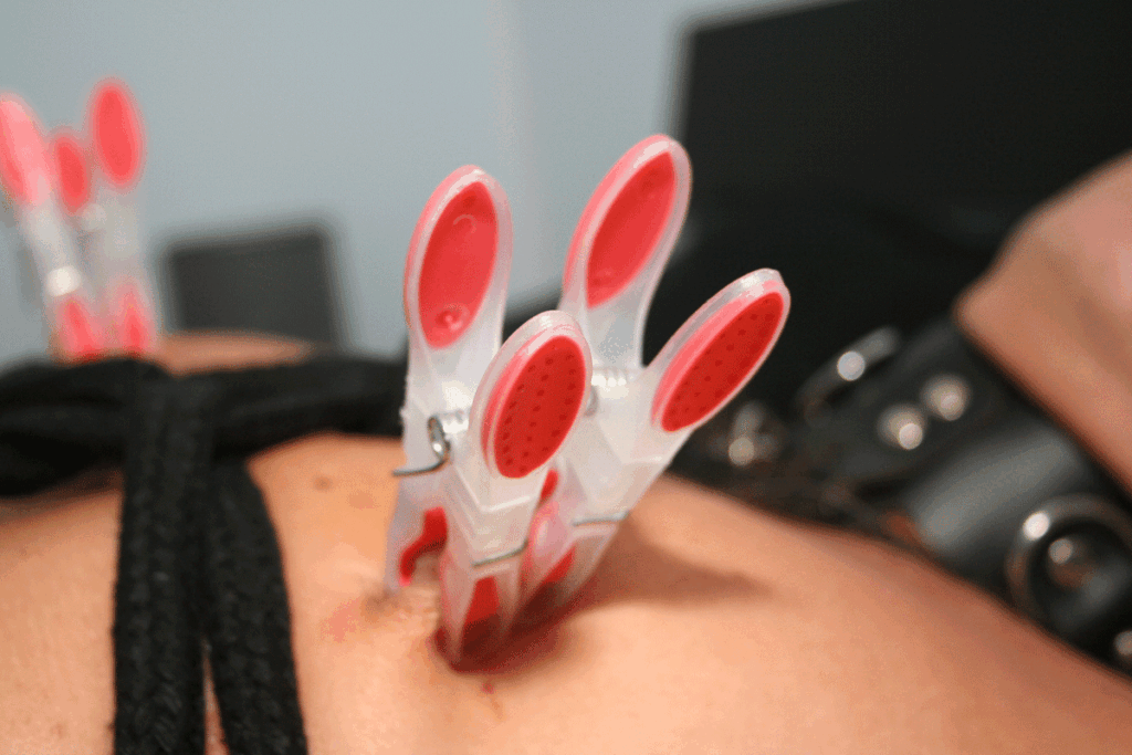 De mogelijkheden van nipple torture of tepelmarteling