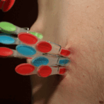 Knijpers, een goedkope klem voor ieder lichaamsdeel