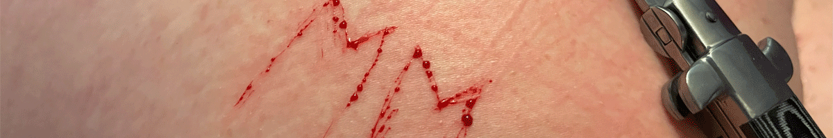 Themapagina: Scarification: van brandmerk tot knifeplay!