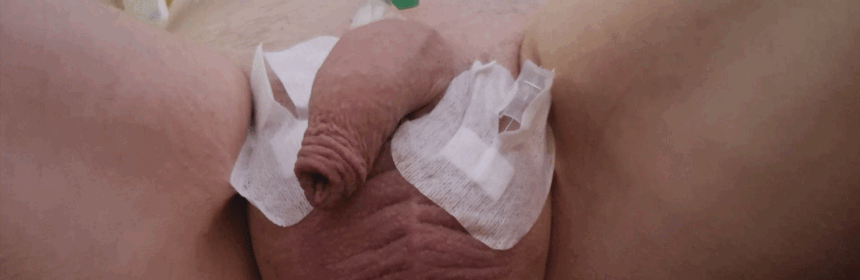 Zoutoplossing en scrotale infusie binnen BDSM